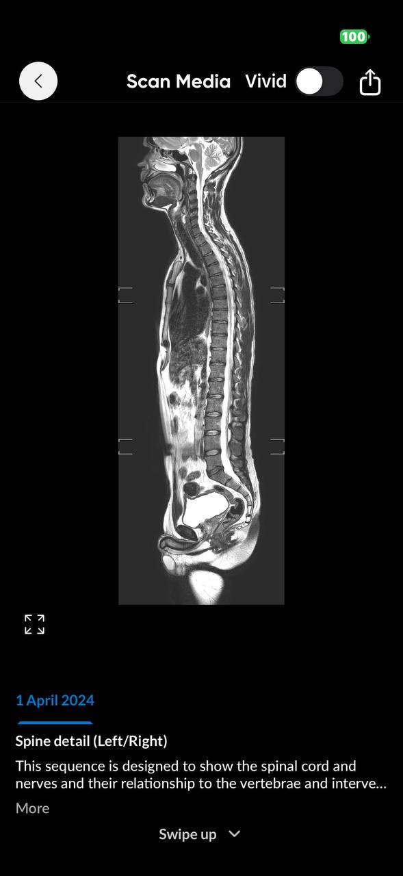 Spine