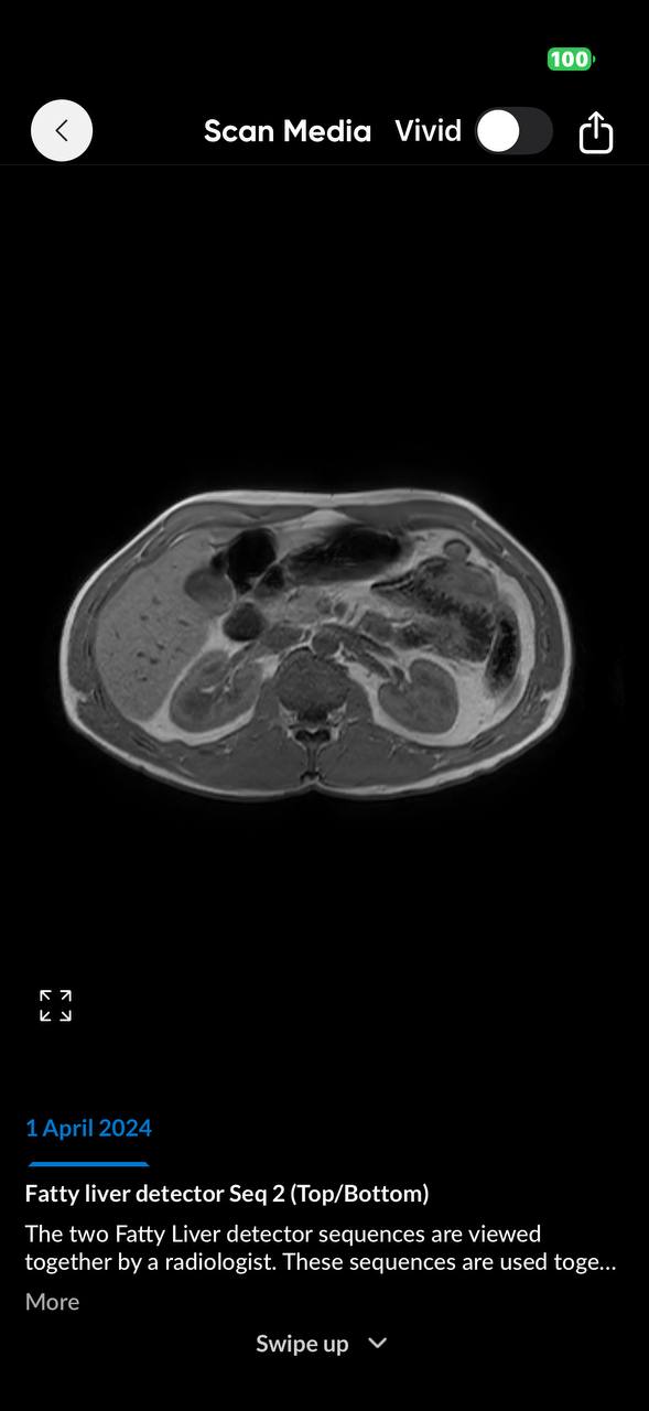 Liver 2