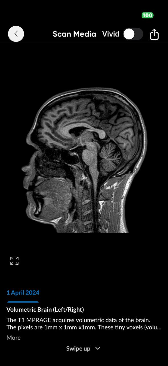 Brain