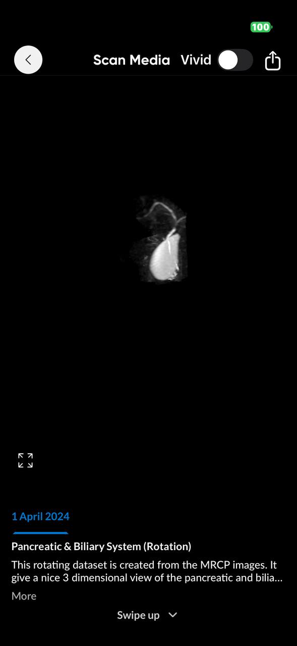 MRCP